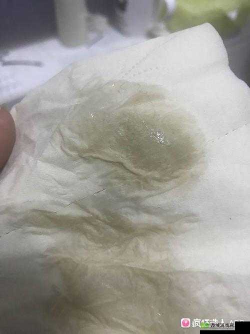 水拉丝了小东西怎么办：快来看看解决办法